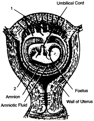 ICSE Biology Question Paper 2007 Solved for Class 10 - 10