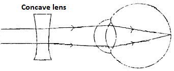 ICSE Biology Question Paper 2009 Solved for Class 10 - 12