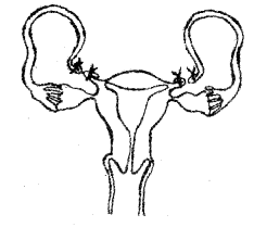 Plus Two Zoology Chapter Wise Previous Questions Chapter 2 Reproductive Health 1