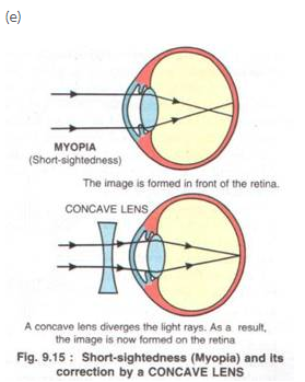 Selina Concise Biology Class 10 ICSE Solutions The Excretory System (Elimination of Body Wastes) image - 4