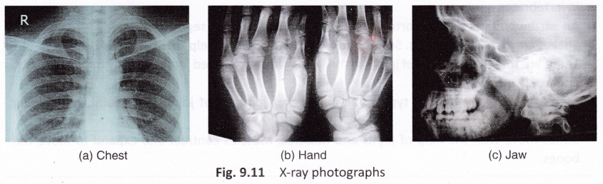 What Is The Function Of The Human Skeleton 5